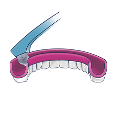 Czym czyścić protezy zębowe i aparat ortodontyczny ruchomy?